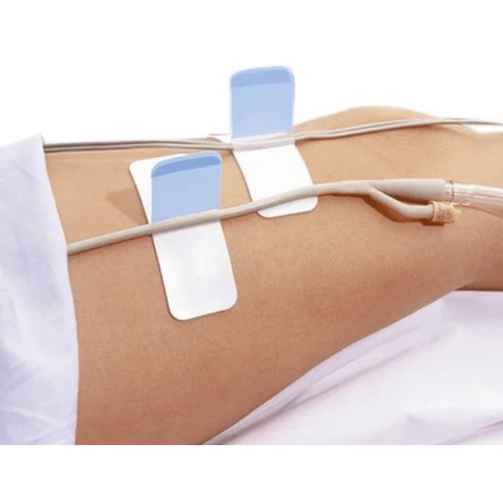 FlexiTrak Dispositivo para Fixação de Sondas e Cateteres ConvaTec